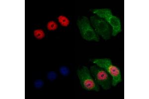 ABIN7094046 and ABIN7098090 staining Hela cells by IF/ICC. (ZNF238 anticorps  (Internal Region))