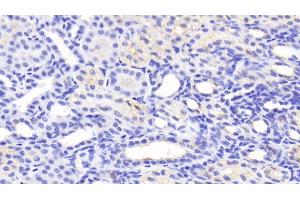 Detection of MFN1 in Human Kidney Tissue using Polyclonal Antibody to Mitofusin 1 (MFN1) (MFN1 anticorps  (AA 1-227))