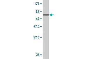Western Blot detection against Immunogen (70. (CTH anticorps  (AA 1-405))
