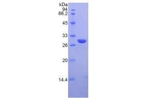 SDS-PAGE analysis of Mouse IRAK2 Protein. (IRAK2 Protéine)