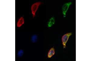 ABIN6264260 and ABIN6268782 staining Hela by IF/ICC. (PKM2 anticorps  (Internal Region))