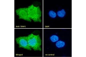 (ABIN184675) Immunofluorescence analysis of paraformaldehyde fixed HepG2 cells, permeabilized with 0.