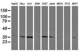 Image no. 2 for anti-Cyclin-Dependent Kinase 2 (CDK2) antibody (ABIN1497399) (CDK2 anticorps)