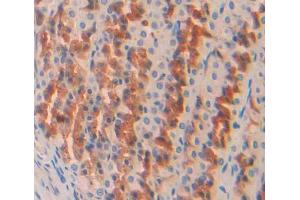 Used in DAB staining on fromalin fixed paraffin- embedded stomach tissue