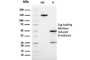 SDS-PAGE Analysis Purified Calprotectin Mouse Monoclonal Antibody (S100A9/1075). (S100A9 anticorps)