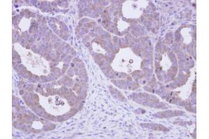 IHC-P Image Immunohistochemical analysis of paraffin-embedded NCIN87 xenograft, using TCP-1 epsilon, antibody at 1:500 dilution.