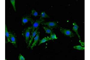 Immunofluorescent analysis of Hela cells using ABIN7157798 at dilution of 1:100 and Alexa Fluor 488-congugated AffiniPure Goat Anti-Rabbit IgG(H+L)