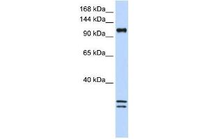 Western Blot showing NCKAP1L antibody used at a concentration of 1-2 ug/ml to detect its target protein. (NCKAP1L anticorps  (C-Term))