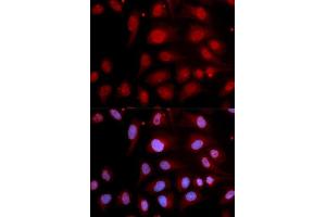 Immunofluorescence analysis of U2OS cell using POLB antibody.