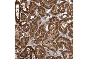 Immunohistochemical staining (Formalin-fixed paraffin-embedded sections) of human kidney shows strong cytoplasmic positivity in tubular cells.