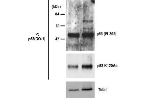 Western Blotting (WB) image for anti-Tumor Protein P53 (TP53) (acLys315) antibody (ABIN3201007) (p53 anticorps  (acLys315))