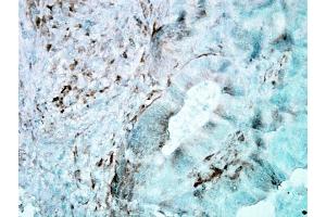 Immunohistochemistry analysis using Mouse Anti-Hsp27 Monoclonal Antibody, Clone 8A7 (ABIN361755 and ABIN361756).