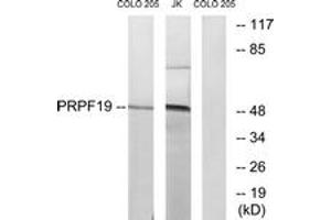 Western blot analysis of extracts from COLO/Jurkat cells, using PRPF19 Antibody. (PRP19 anticorps  (AA 171-220))