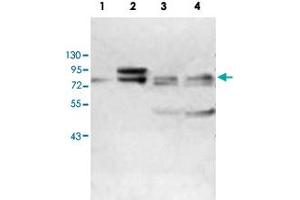 Western blot analysis of human fetal kidney (Lane 1) and MCF-7 cell (Lane 2), K-562 cell (Lane 3) and HeLa cell (Lane 4) lysates with ABCF3 polyclonal antibody  at 1 : 500 dilution. (ABCF3 anticorps  (AA 442-681))
