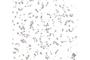 Immunocytochemistry (ICC) image for anti-Epidermal Growth Factor Receptor (EGFR) (C-Term) antibody (ABIN7795642) (Recombinant EGFR anticorps  (C-Term))