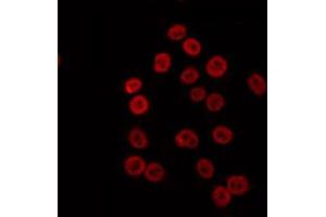 ABIN6274692 staining K562 by IF/ICC. (MLH1 anticorps  (Internal Region))