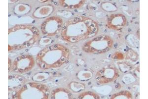 Detection of FN in Human Kidney Tissue using Polyclonal Antibody to Fibronectin (FN)