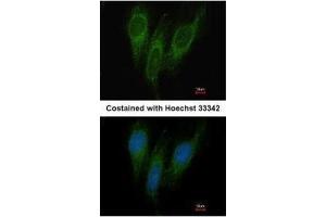 ICC/IF Image Immunofluorescence analysis of methanol-fixed HeLa, using DNAJC1, antibody at 1:200 dilution.