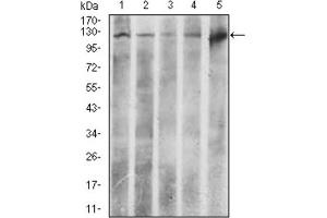 Western blot analysis using ACLY antibody against HeLa (1), NIH3T3 (2), C6 (3), COS7 (4), and Raji (5) cell lysate.