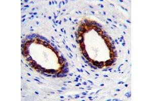 Cytokeratin-18 antibody immunohistochemistry analysis in formalin fixed and paraffin embedded human prostate carcinoma.