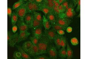 IF analysis of HLTF using anti-HLTF antibody (ABIN4886619) and anti-Tubulin Alpha antibody (ABIN7600339). (HLTF anticorps  (AA 911-1009))