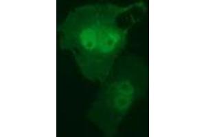 Anti-RIT2 mouse monoclonal antibody (ABIN2453598) immunofluorescent staining of COS7 cells transiently transfected by pCMV6-ENTRY RIT2 (RC205367). (RIT2 anticorps)
