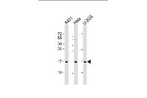 All lanes : Anti-RPLP1 Antibody (N-Term) at 1:2000 dilution Lane 1: A431 whole cell lysate Lane 2: Hela whole cell lysate Lane 3: U-2OS whole cell lysate Lysates/proteins at 20 μg per lane. (RPLP1 anticorps  (AA 18-49))