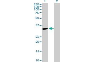 Western Blot analysis of TYMS expression in transfected 293T cell line by TYMS MaxPab polyclonal antibody. (TYMS anticorps  (AA 1-313))