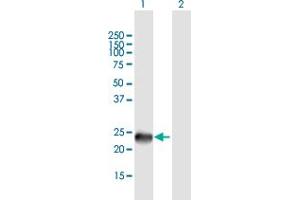 Western Blot analysis of SSX9 expression in transfected 293T cell line by SSX9 MaxPab polyclonal antibody. (SSX9 anticorps  (AA 1-188))