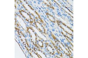 Immunohistochemistry of paraffin-embedded mouse kidney using CTNNA1 antibody.