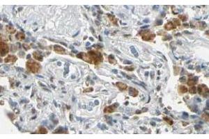 Image no. 2 for anti-Fanconi Anemia Complementation Group G (FANCG) (AA 1-12), (N-Term) antibody (ABIN401267) (FANCG anticorps  (N-Term))