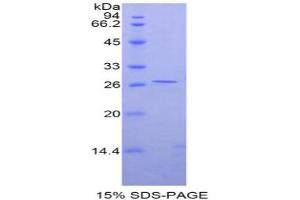 SDS-PAGE analysis of Rat GATA Binding Protein 4 Protein. (GATA4 Protéine)