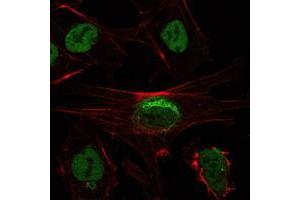 Immunofluorescence analysis of NTERA-2 cells using SIRT1 mouse mAb (green). (SIRT1 anticorps)