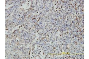 Immunoperoxidase of monoclonal antibody to NUCB1 on formalin-fixed paraffin-embedded human spleen tissue.