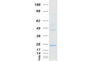 Validation with Western Blot
