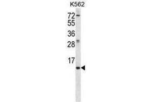 MEIG1 Antibody (Center) western blot analysis in K562 cell line lysates (35µg/lane). (MEIG1 anticorps  (Middle Region))