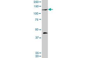 PRDM1 monoclonal antibody (M01), clone 2B10.