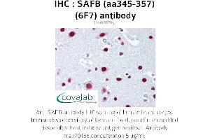 Image no. 1 for anti-Scaffold Attachment Factor B (SAFB) (AA 345-357) antibody (ABIN1723104)