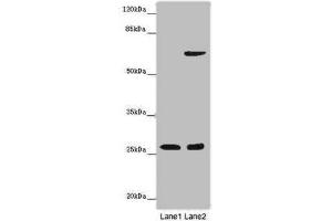 Western blot All lanes: SOX14 antibody at 14 μg/mL Lane 1: Human placenta tissue Lane 2: HepG2 whole cell lysate Secondary Goat polyclonal to rabbit IgG at 1/10000 dilution Predicted band size: 27 kDa Observed band size: 27 kDa (SOX14 anticorps  (AA 1-137))