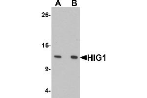 Western blot analysis of HIG1 in 293 cell lysate with HIG1 antibody at at (A) 0. (HIGD1A anticorps  (N-Term))