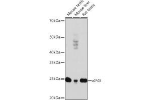 Western blot analysis of extracts of various cell lines, using eIF4E antibody (ABIN7267048) at 1:1000 dilution.