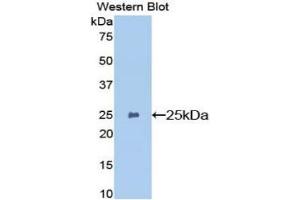 Detection of Recombinant GSTp, Mouse using Polyclonal Antibody to Glutathione S Transferase Pi (GSTp) (GSTP1 anticorps  (AA 1-210))