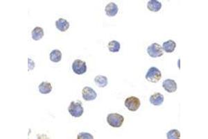 Immunocytochemistry of TSC2 in L1210 cells with this product at 10 μg/ml.