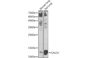 Western blot analysis of extracts of various cell lines, using CALCA antibody (ABIN7266005) at 1:1000 dilution.