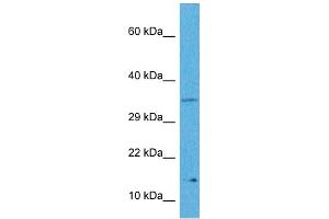 Host:  Rabbit  Target Name:  MYCNOS  Sample Tissue:  Human Hela Whole Cell  Antibody Dilution:  1ug/ml (MYCNOS anticorps  (N-Term))