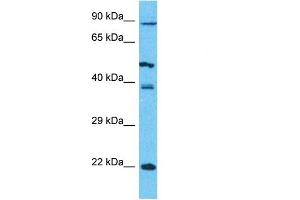 Host:  Rabbit  Target Name:  PCDHB5  Sample Type:  293T Whole Cell lysates  Antibody Dilution:  1. (PCDHb5 anticorps  (N-Term))