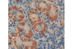 Used in DAB staining on fromalin fixed paraffin- embedded stomach tissue (Phospholipase C beta 2 anticorps  (AA 1-250))