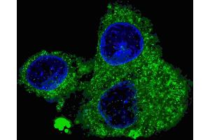 Fluorescent confocal image of HepG2 cells stained with FASN (Center) antibody. (Fatty Acid Synthase anticorps  (AA 942-973))