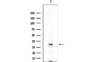 Western blot analysis of lysates from COLO205 cells(heat-shock treatment), using PDIK1L Antibody at 1/1000 dilution.