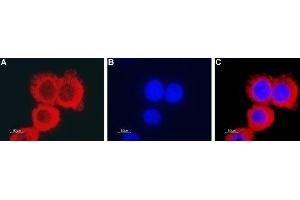Expression of CLIC1 in human colorectal adenocarcinoma HT-29 cells - Immunocytochemical staining of fixed and permeabilized human colorectal adenocarcinoma HT-29 cells.